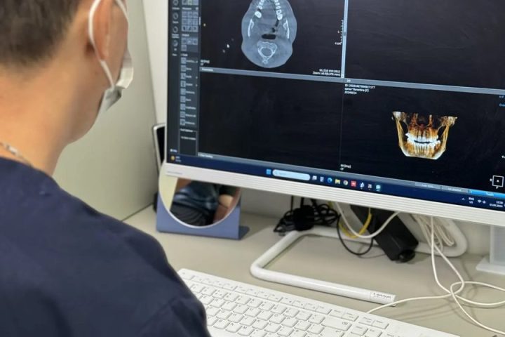 Analiză CBCT digitală pe monitor la Clinica 32